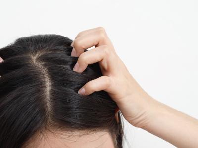 為什麼總是頭皮發癢？該如何改善？