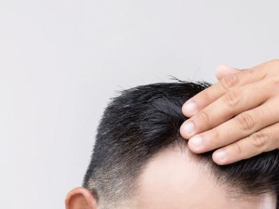 男性保養從頭皮做起最好入手!