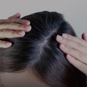 2/將頭髮撥開,讓頭皮露出。